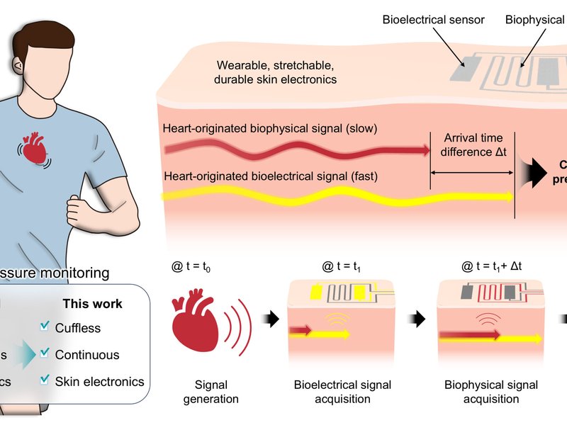 New bandage-like wearable monitor to enable continuous measurement of BP