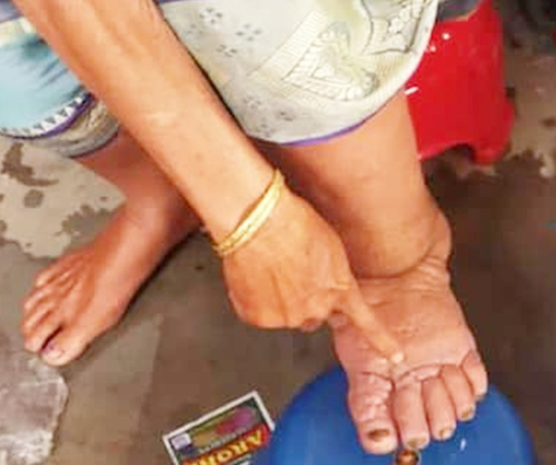 योगी सरकार रात्रि चौपाल, नुक्कड़ नाटक और एमडीए यात्रा से फालेरिया काे दे रही मात 