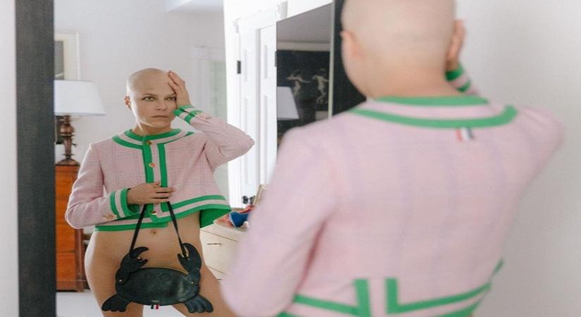  'i Deserve Love Again,' Says Selma Blair Following 2018 Ms Diagnosis-TeluguStop.com