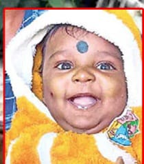  5-month-old Boy Dies In Attack By Stray Dogs In Hyderabad-TeluguStop.com