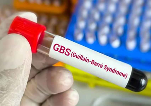 GBS outbreak: Mumbai reports first death