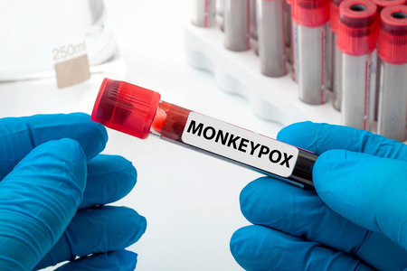 Uganda sees nearly 70 pc drop in mpox cases over four weeks