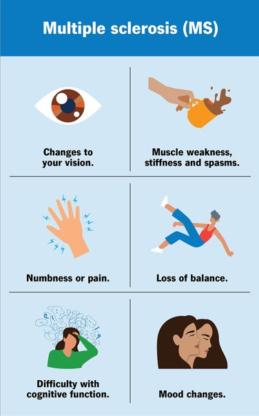 Multiple sclerosis may emerge a decade before neurological symptoms begin to appear