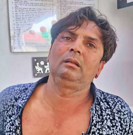 Delhi CM attack case deepens; police arrest Rajesh’s associate Tahseen in alleged murder plot