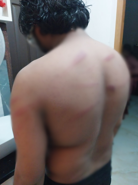 Man alleges police brutality and harassment against son in Kerala