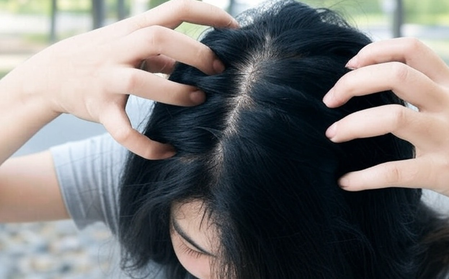 सर्दियों में सिर की खुजली से परेशान? अपनाएं ये आसान उपाय सर्दियों में सिर की खुजली से परेशान? अपनाएं ये आसान उपाय