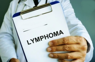 CAR-T cell therapy, bone marrow transplant boosting Lymphoma outcomes: Experts CAR-T cell therapy, bone marrow transplant boosting Lymphoma outcomes: Experts