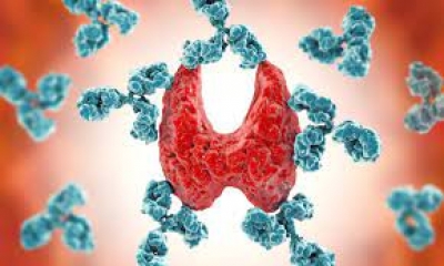 Why are autoimmune diseases more prevalent in women?